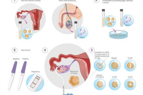 http://zhuhai.dacou.net/post/202.html|珠海人工试管